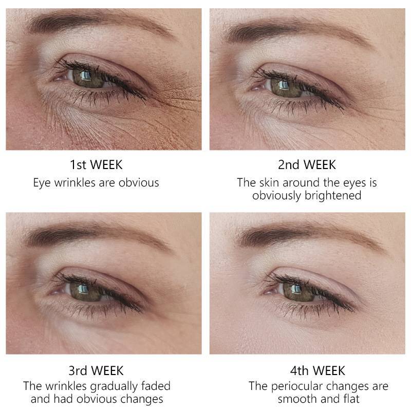 Eye Serum Repairs And Tightens Fine Lines Around Eyes