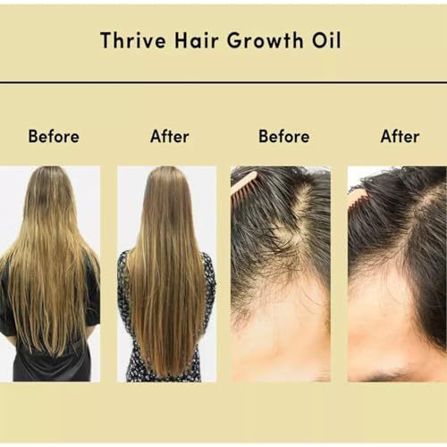 Veganic Natural Hair Growth Oil stimulates new growth, reduce hair fall, shine and volume and improve scalp health