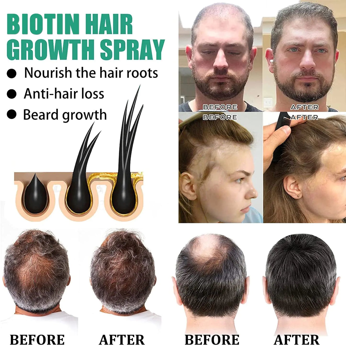 Biotin Hair Care Essential Oils